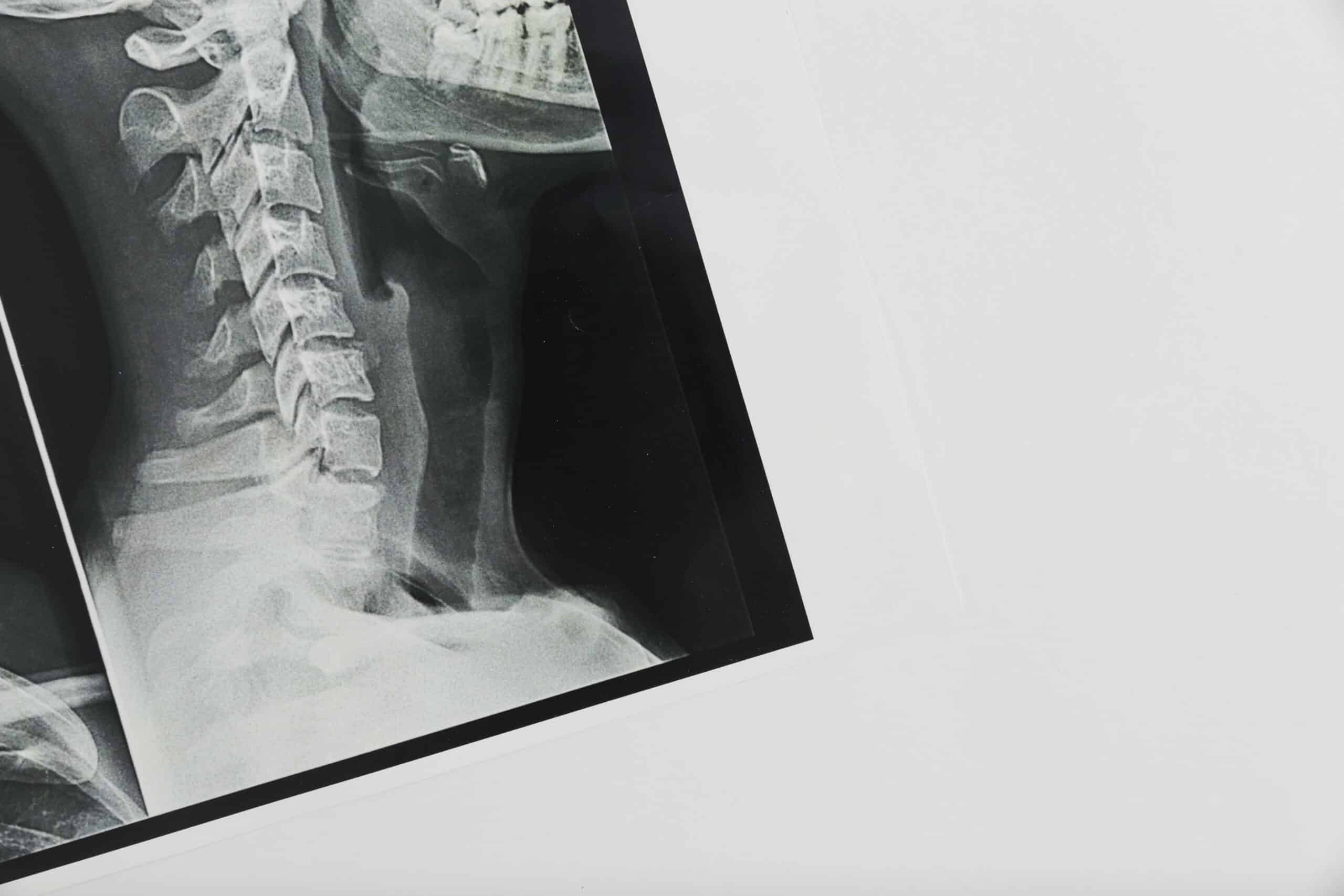 Radiographie